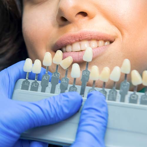 How much is it to get your teeth whitened at the dentist?